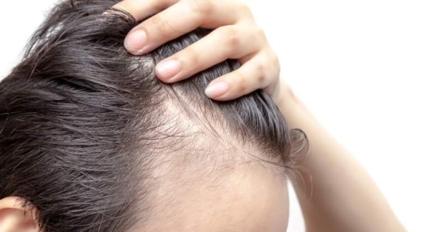 Tratamientos Capilares para Hombres y Mujeres